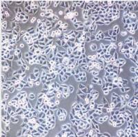 人肺腺癌细胞实验