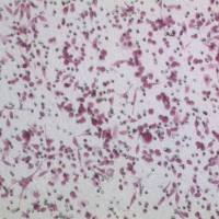 癌细胞迁移实验