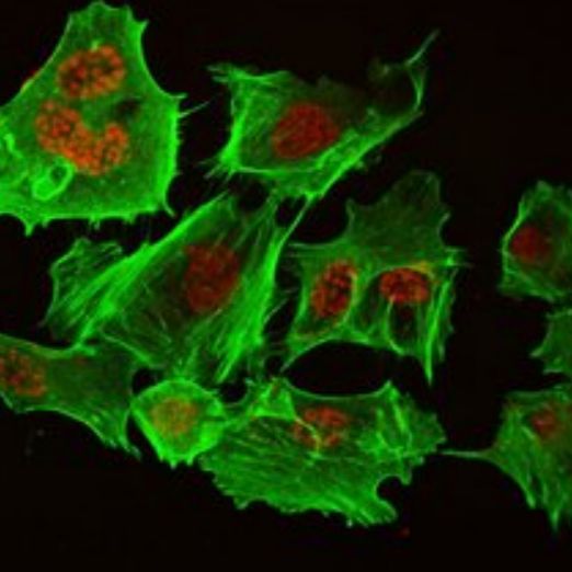 细胞免疫荧光三标实验