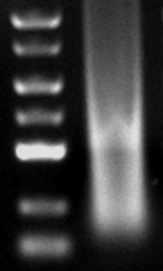 CHIP 染色质免疫共沉淀实验
