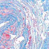 石蜡样本MASSON染色实验
