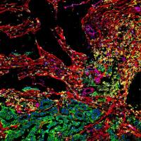 小鼠肿瘤浸润白细胞（TIL）流式表型分析