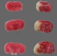 大小鼠脑卒中（MCAO）脑缺血再灌注模型