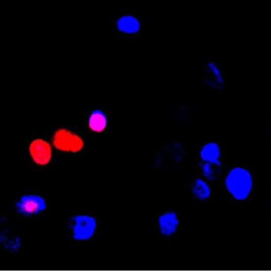 细胞免疫荧光双标实验