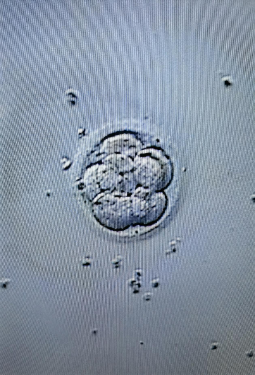 移植第五天胚胎图图片