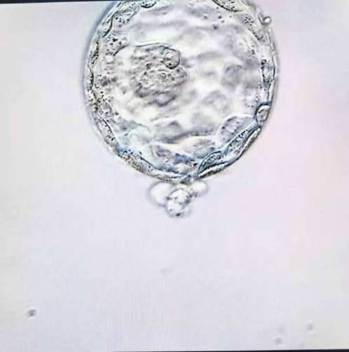 体外培养至第五天的优质囊胚期胚胎