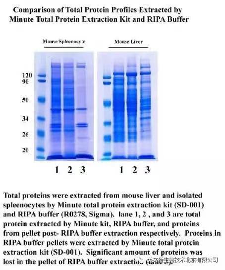 WB目标蛋白就在Cell lysate与Total protein的差别之间！进来帮你找到它！