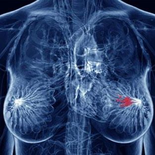 肿瘤类器官|​​靶向Trop-2的三阴性乳腺癌类器官