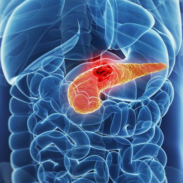 肿瘤类器官|胰腺癌类器官模型