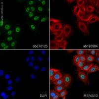 Alexa Fluor® 488 Anti-p53 antibody [SP161]