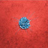 全血DC细胞亚群特征分析