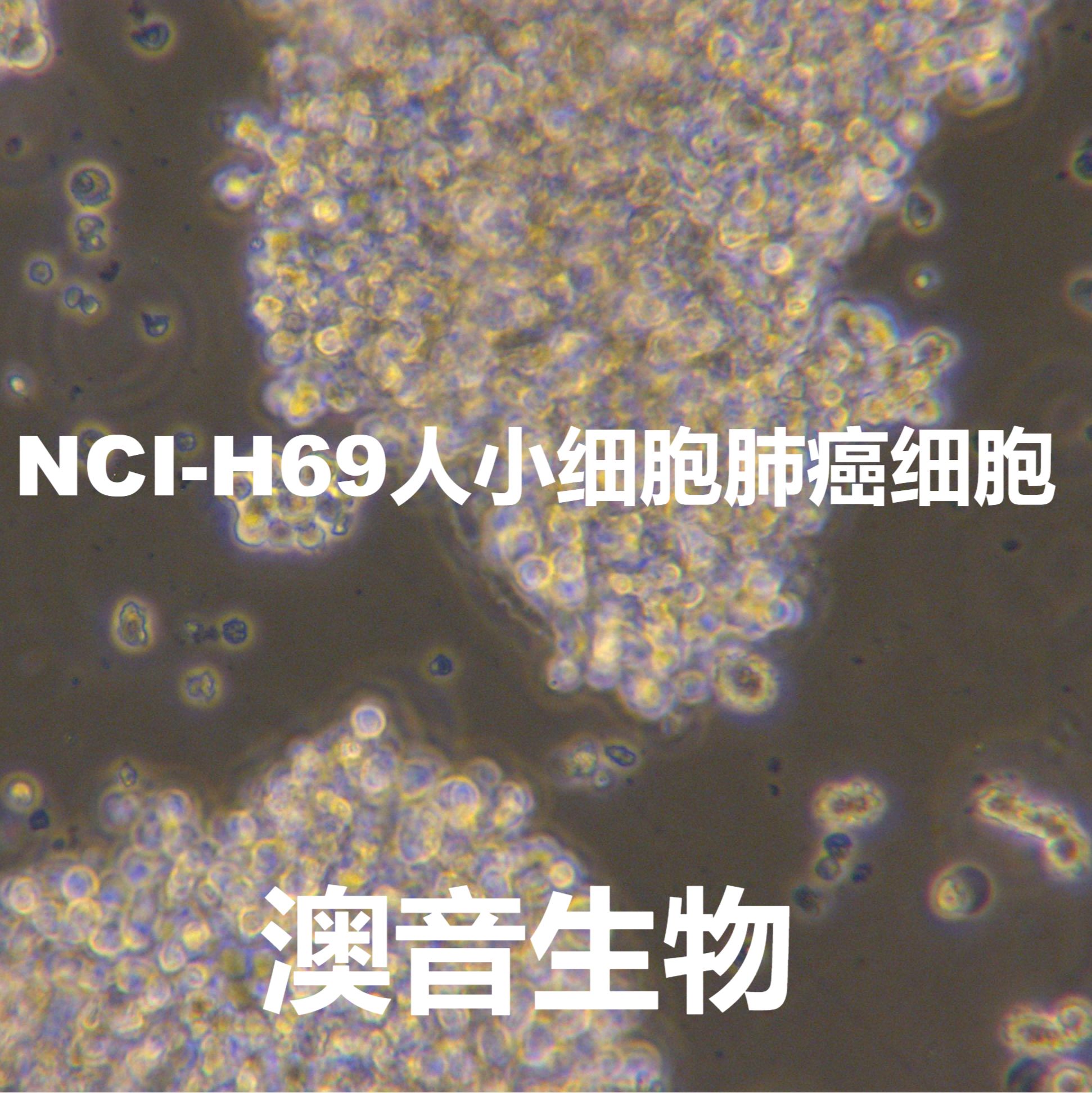 NCI-H69【NCI-H-69; NCI H69; H69; H-69; NCIH69; NCI-HUT-69; H69/P; NCI-H69C; H69C; H69c】人小细胞肺癌细胞