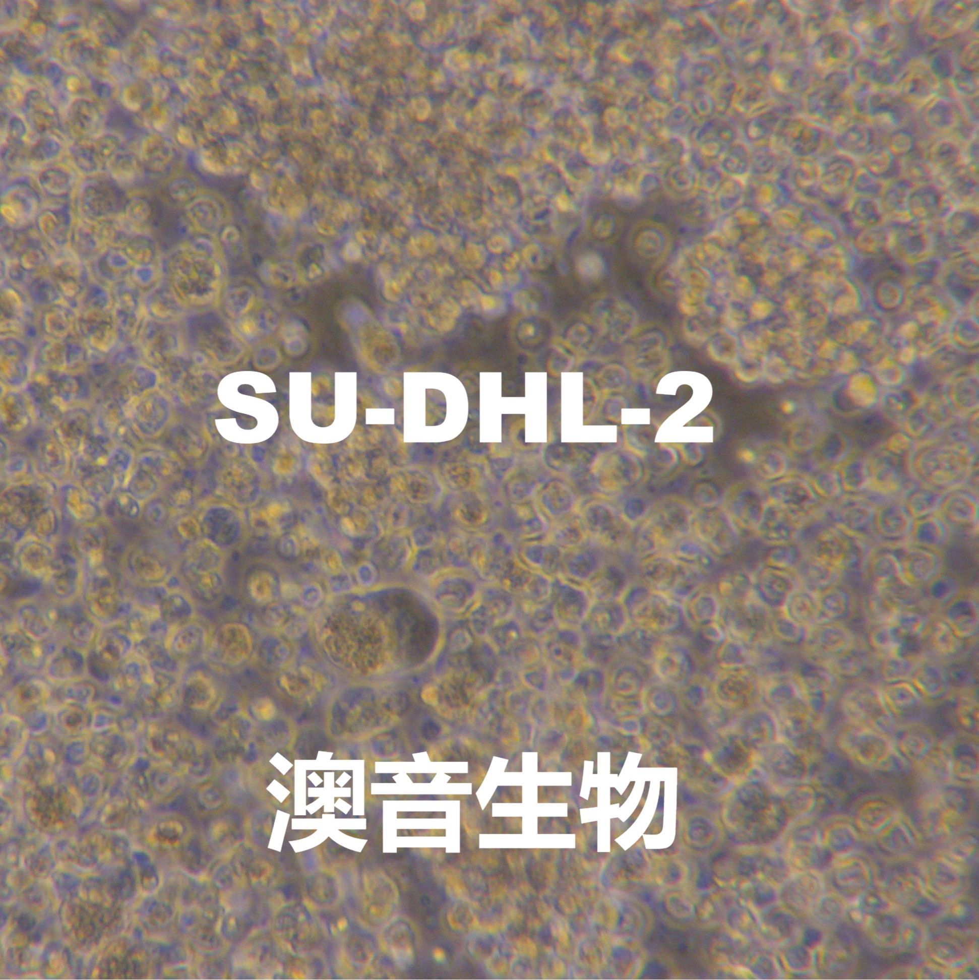 SU-DHL-2【SUDHL2; SUDHL-2; Su-DHL-2; SU-DHL2; SuDHL 2】人弥漫性大B细胞淋巴瘤细胞