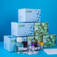 莱克多巴胺单克隆抗体-齐一生物