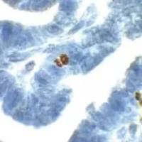 细胞凋亡检测试剂盒