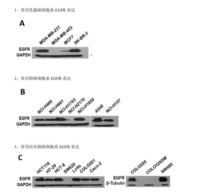 常用肿瘤细胞系EGFR表达