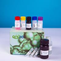 谷氨酸脱氢酶(GDH)酶活测定试剂盒