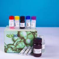 脂蛋白酯酶(LPL)酶活测定试剂盒