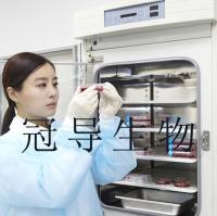 HCCC-9810 Cells;人胆管细胞型肝癌体外鲜活细胞|STR鉴定图谱