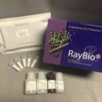 新冠抗体结合抑制分析试剂盒