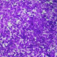 细胞迁移（Transwell或划痕）