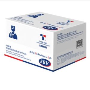 EB病毒核酸检测试剂盒（荧光PCR法）