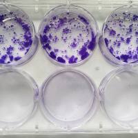 细胞克隆形成实验