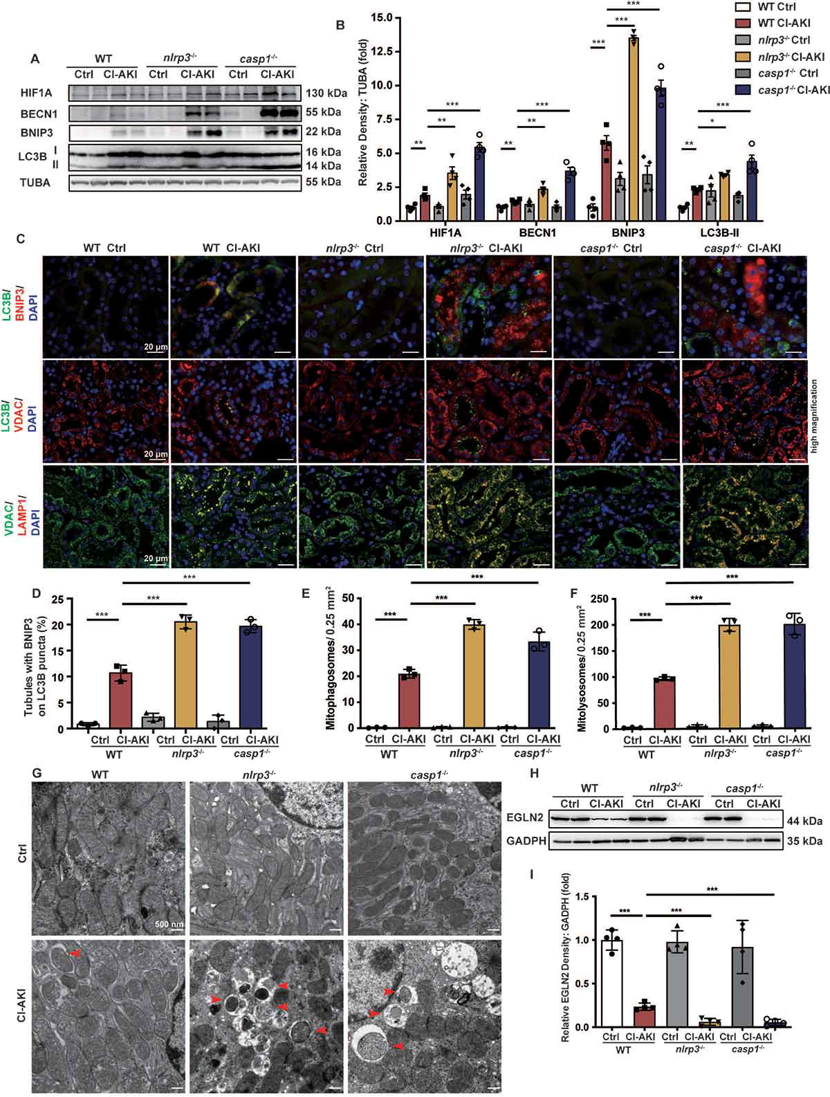 项目文章autophagy线粒体自噬缓解急性肾损伤的分子机制