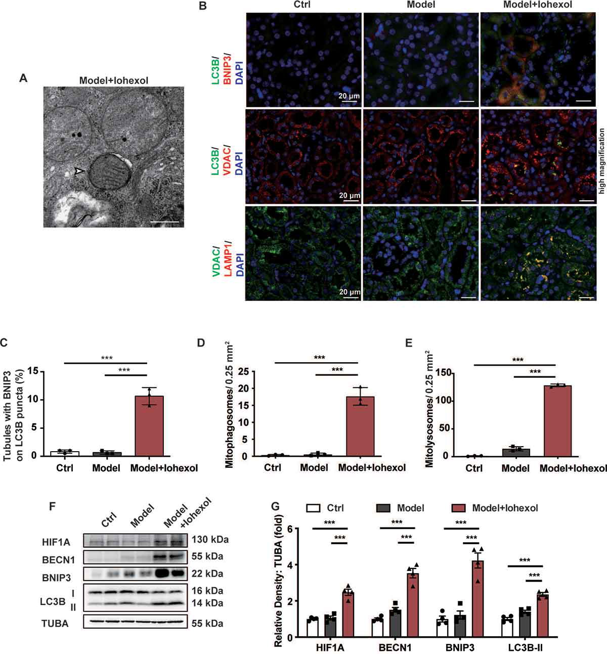 項目文章 | autophagy: 線粒體自噬緩解急性腎損傷的分子機制