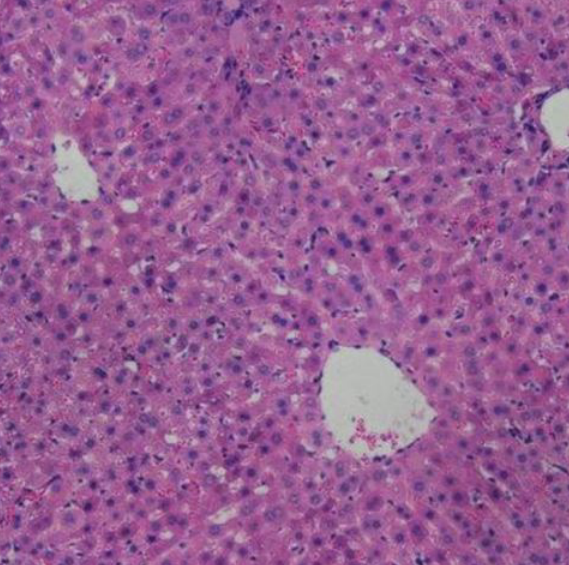 胸腺HE染色实验