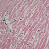 心脏HE染色实验