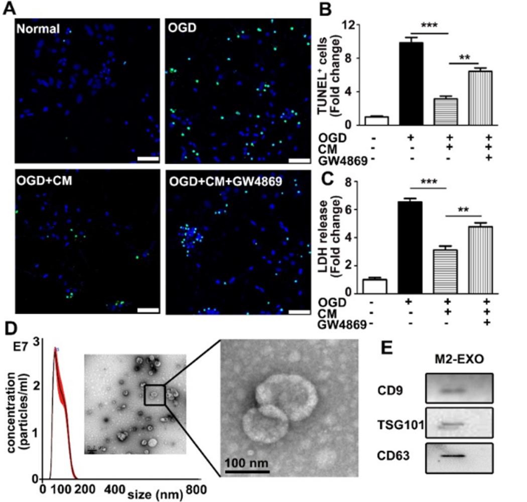 M2小胶质细胞来源的外泌体通过miR-124保护大脑免受缺血再灌注损伤