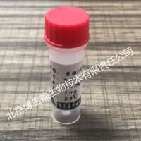 重组戊肝抗原(HEV)