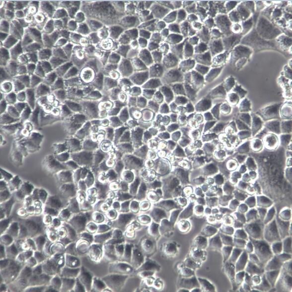 宫颈癌细胞C-33A、C-33A细胞、C33A细胞