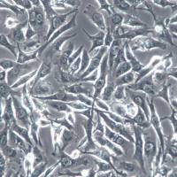 BT549细胞、BT-549细胞、BT549乳腺癌细胞