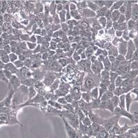 HCC-827细胞、HCC-827细胞、HCC-827细胞