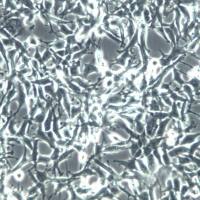 ES2细胞、ES-2细胞、ES-2细胞