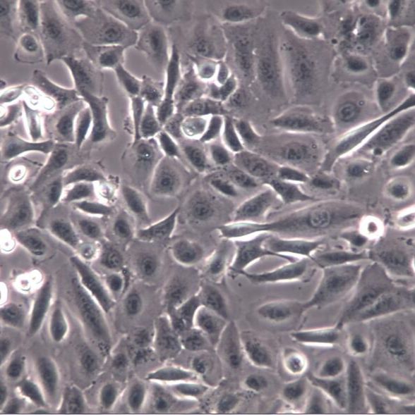 DU145细胞、DU145细胞、DU145前列腺癌细胞