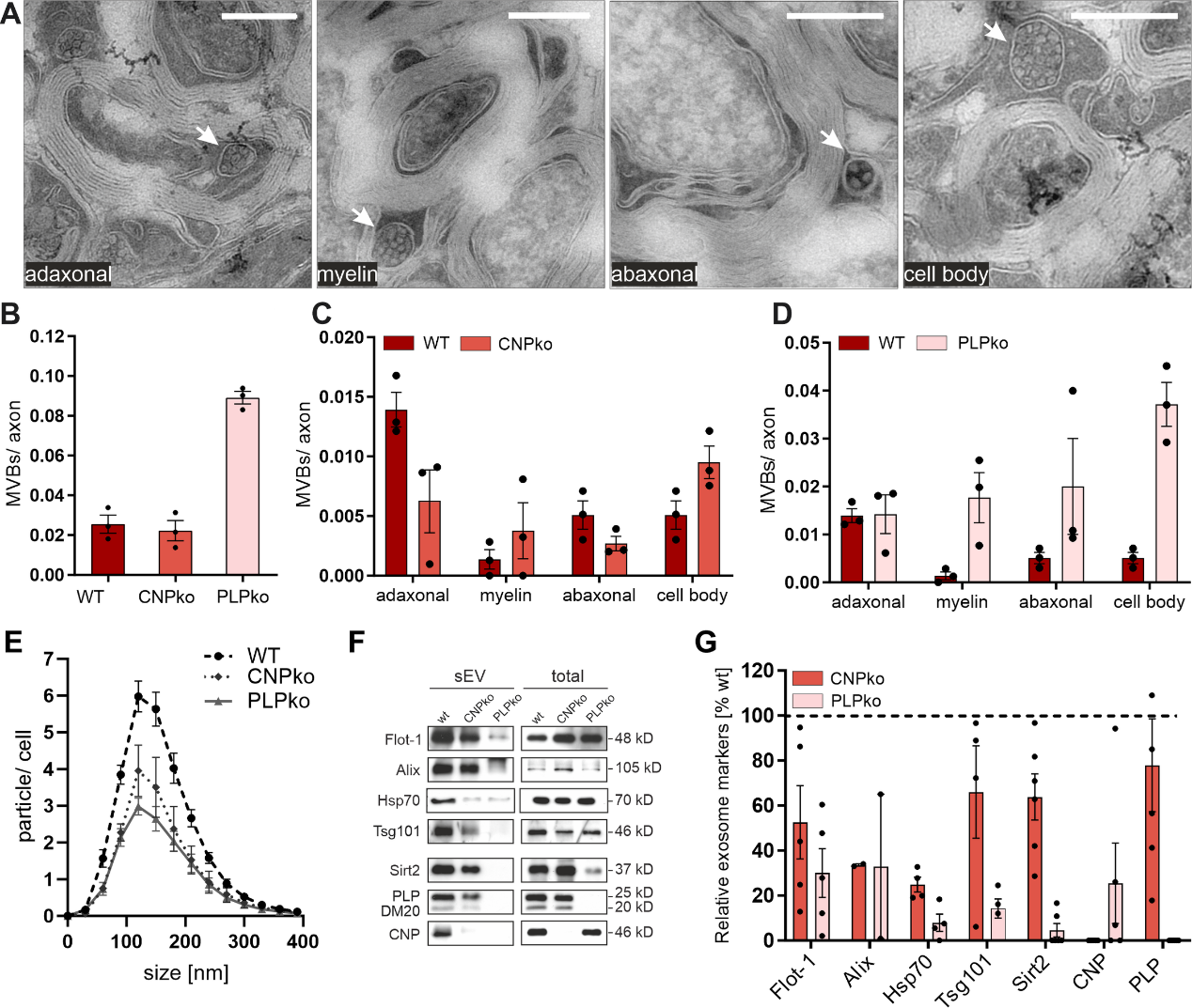 少突胶质细胞分泌外泌体支持轴突转运和维持