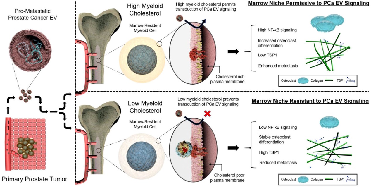 前列腺癌来源的外泌体通过胆固醇的方式与骨髓细胞发生交互作用促进骨转移