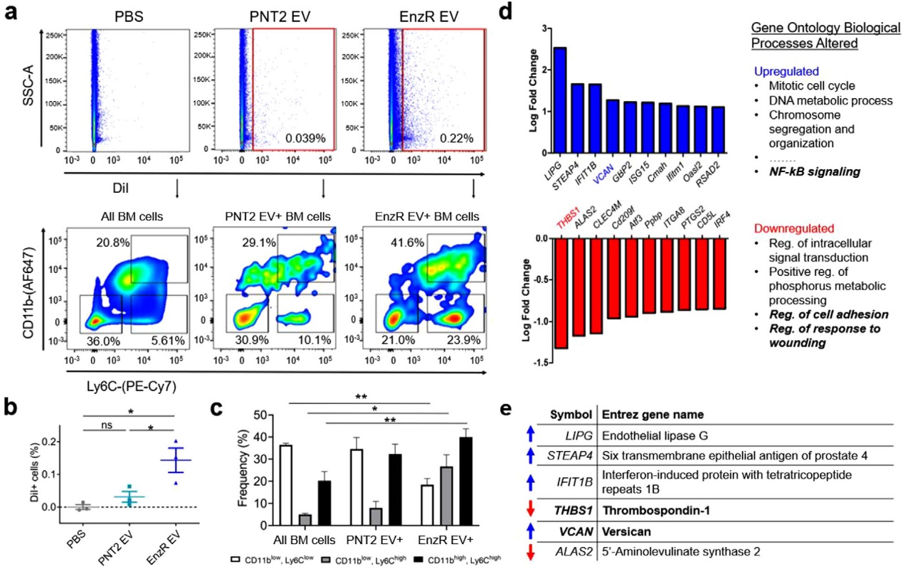 前列腺癌来源的外泌体通过胆固醇的方式与骨髓细胞发生交互作用促进骨转移