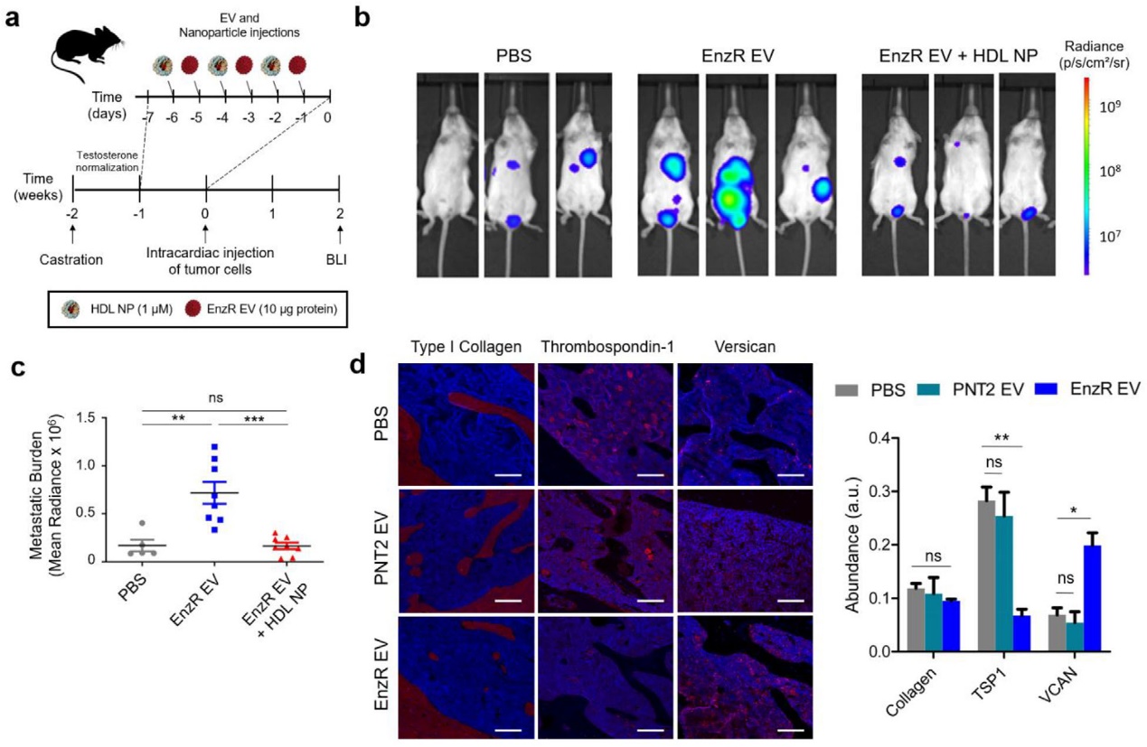 前列腺癌来源的外泌体通过胆固醇的方式与骨髓细胞发生交互作用促进骨转移