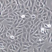 HOS细胞、HOS细胞、HOS细胞