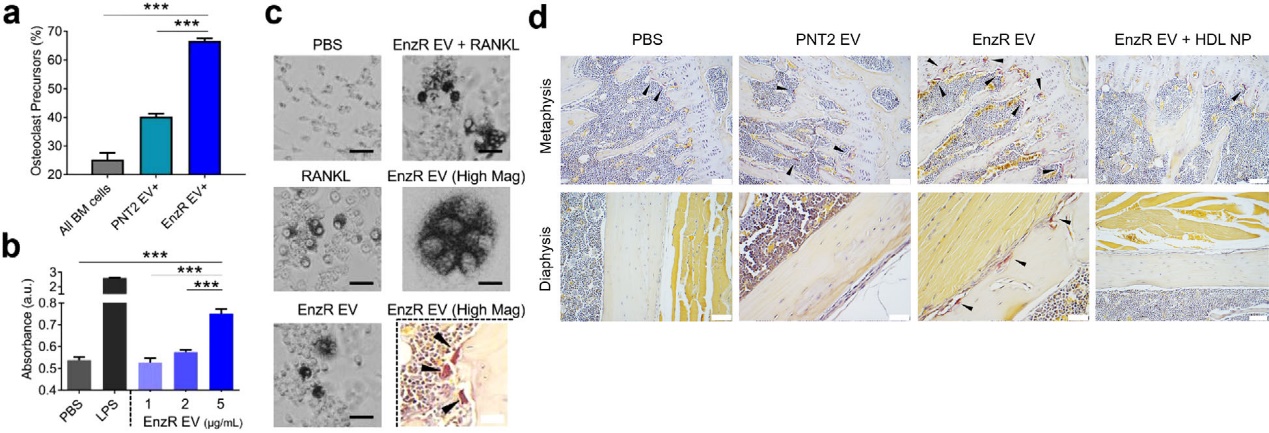 前列腺癌来源的外泌体通过胆固醇的方式与骨髓细胞发生交互作用促进骨转移