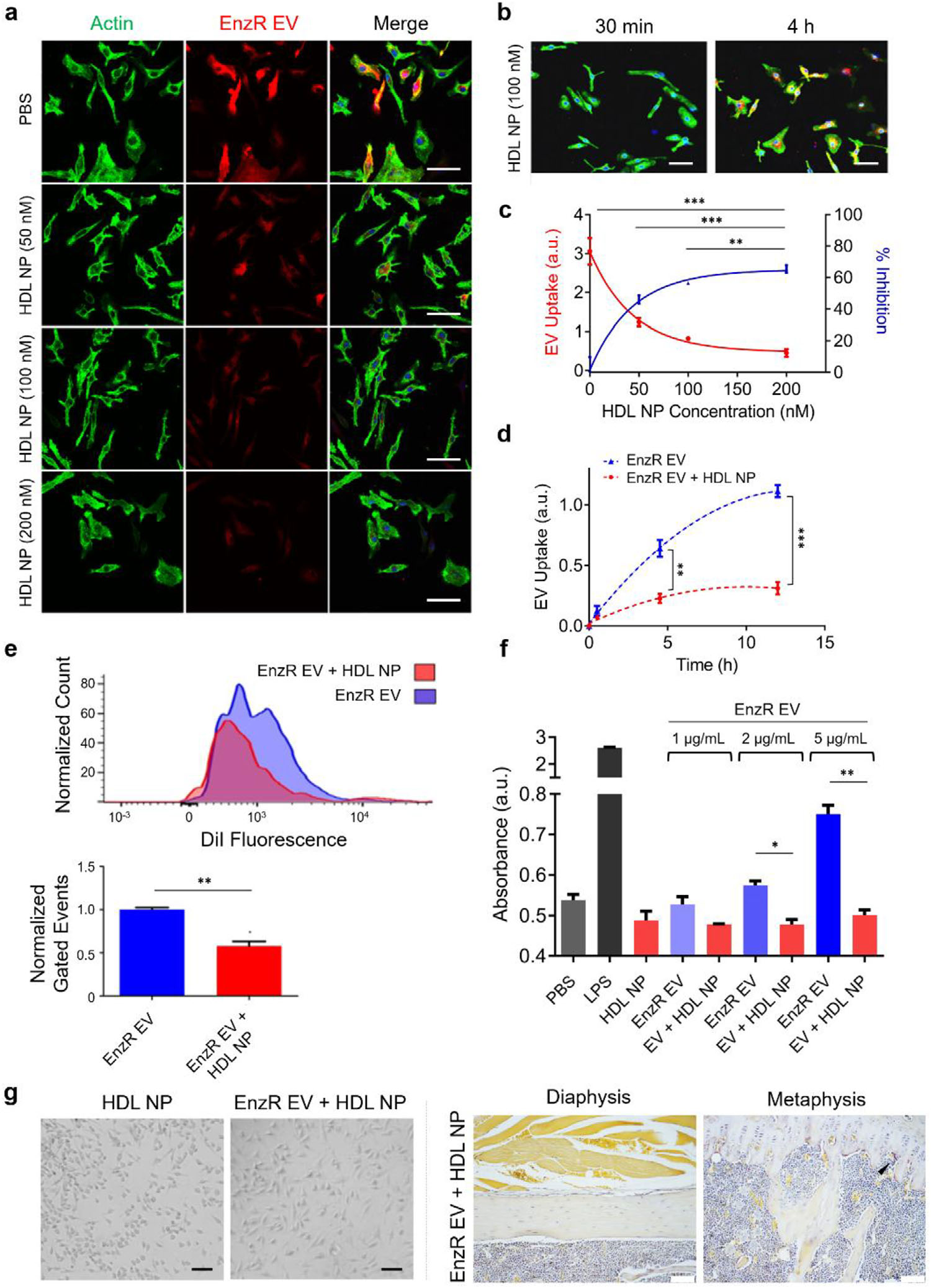 前列腺癌来源的外泌体通过胆固醇的方式与骨髓细胞发生交互作用促进骨转移