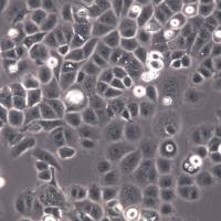 HEC-1-A细胞、HEC-1-A细胞、HEC-1-A细胞