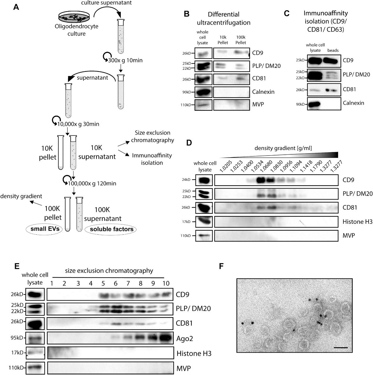 少突胶质细胞分泌外泌体支持轴突转运和维持