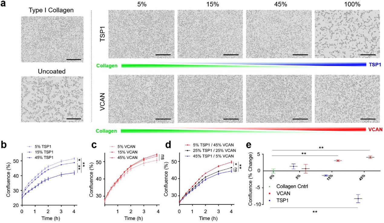 前列腺癌来源的外泌体通过胆固醇的方式与骨髓细胞发生交互作用促进骨转移
