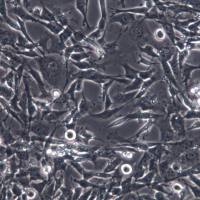 TM4细胞、TM4细胞、TM4细胞