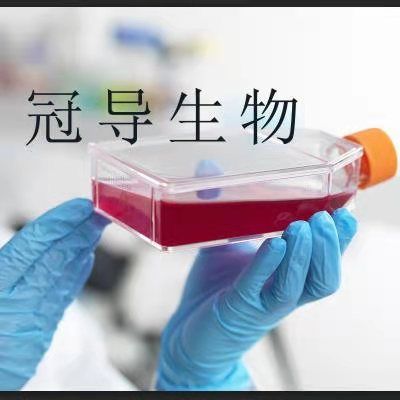 HuTu 80 Cells;人十二指肠腺癌体外鲜活细胞|STR鉴定图谱